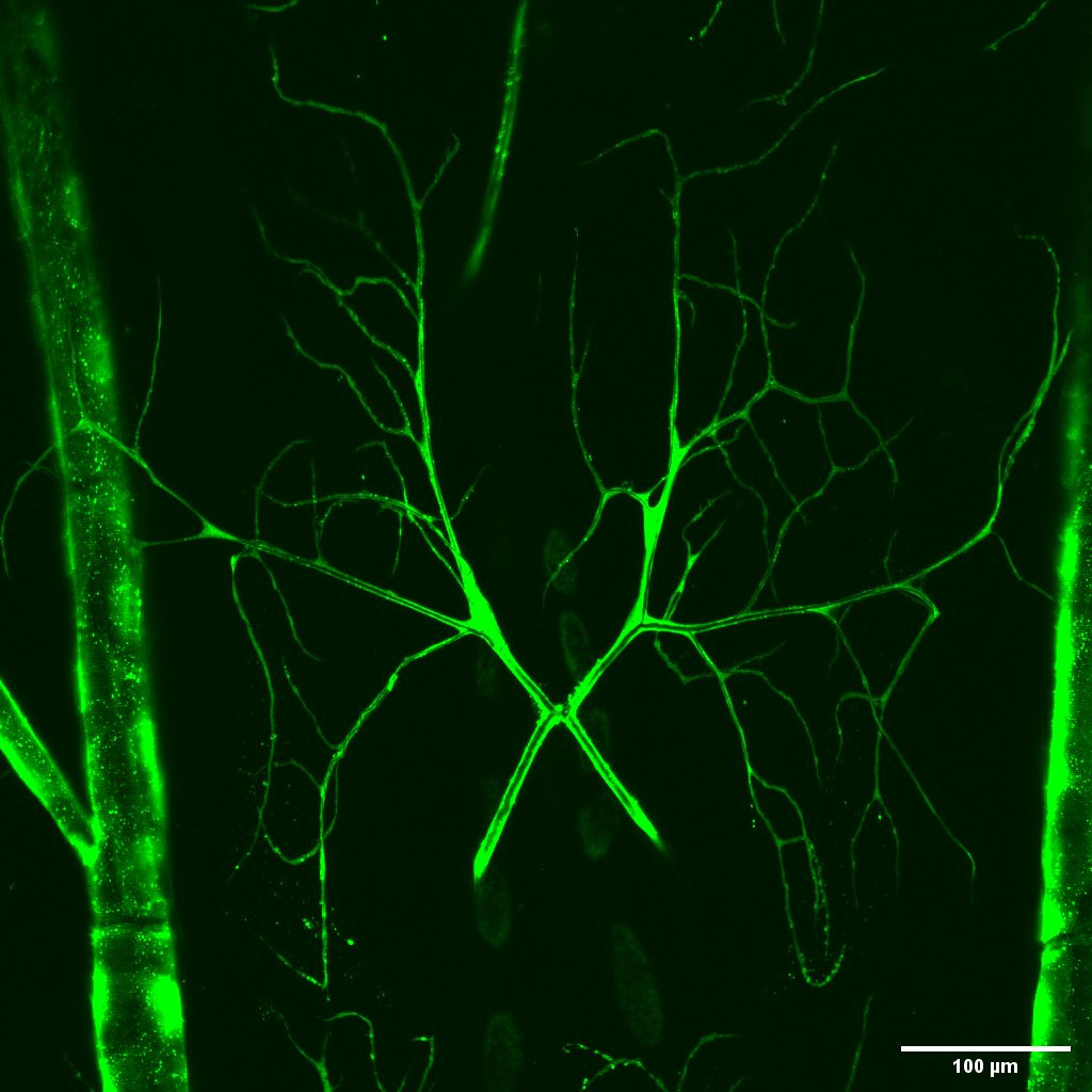 Microscopic view of terminal tracheal cells in a Drosophila larva, highlighting their branched structure for efficient oxygen delivery.