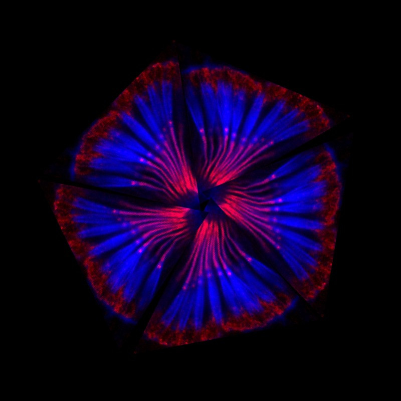 A montage of scolopidia – the structures that fruit flies require for hearing