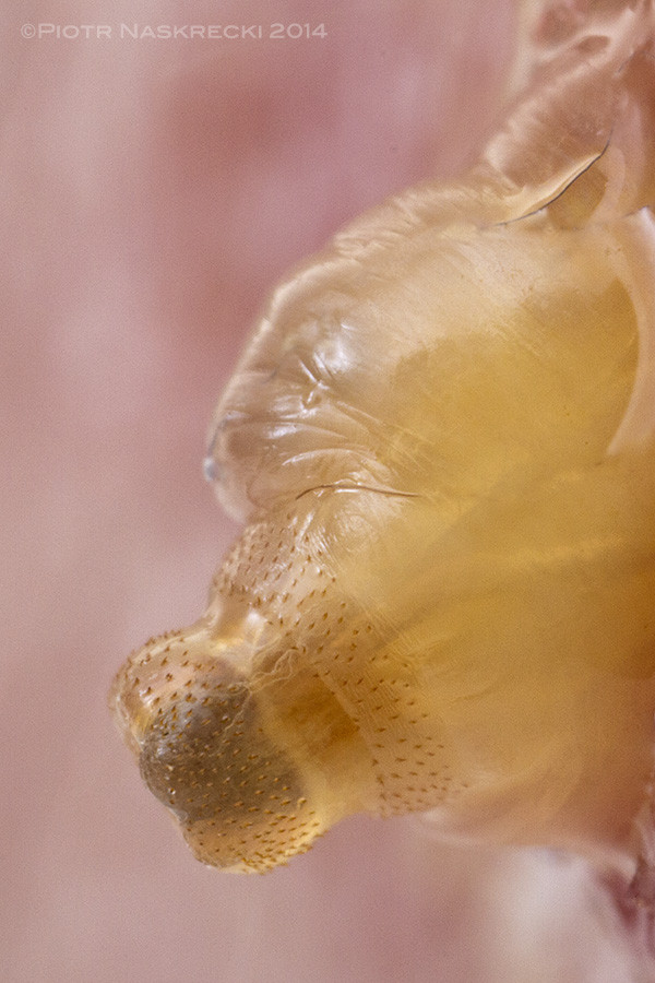 Close-up view of a human botfly larva's breathing tube protruding from the skin, highlighting the initial discovery of the infestation.
