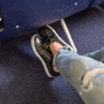 Why Do My Ankles Swell When I Fly? Understanding and Preventing Flight-Related Swelling