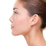 Rhinoplasty consultation