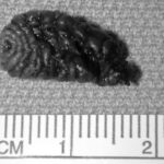 Bot fly larvae burrow into the skin