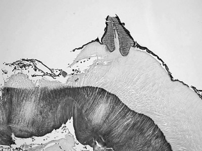 Hematoxylin and eosin-stained photomicrograph section revealing the presence of a chitinous spine on the surface of the botfly larva