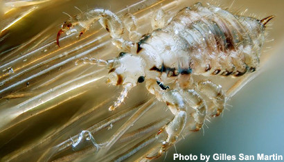 Close-up of head lice clinging to human hair